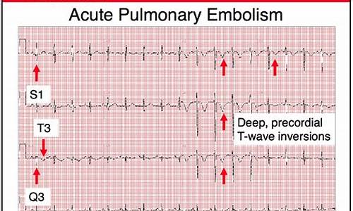 Finding Peace and Joy at Cabo Wabo in Los Cabos, Mexico