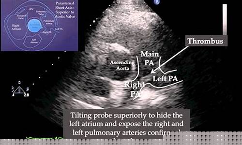 Finding Peace and Serenity in Cabo Wabo Country Song