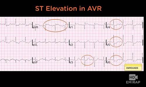 Finding Peace at Cabo Wabo’s Secluded Location